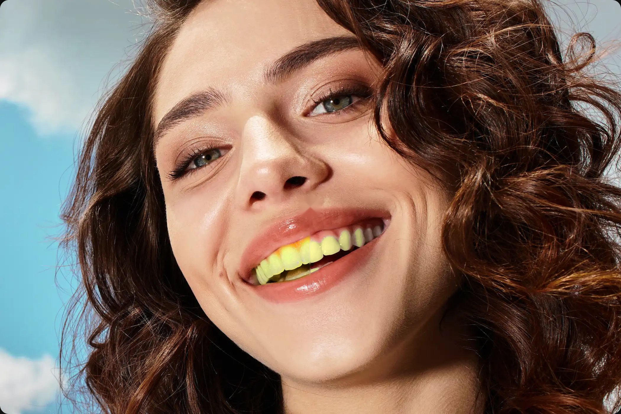 Smile transformation (before)